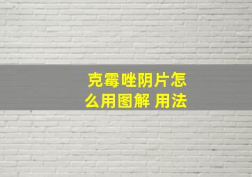 克霉唑阴片怎么用图解 用法